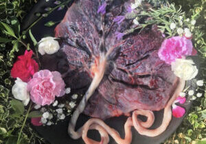 Placenta encapsulation Wollongong - Sacred Feminine Collective